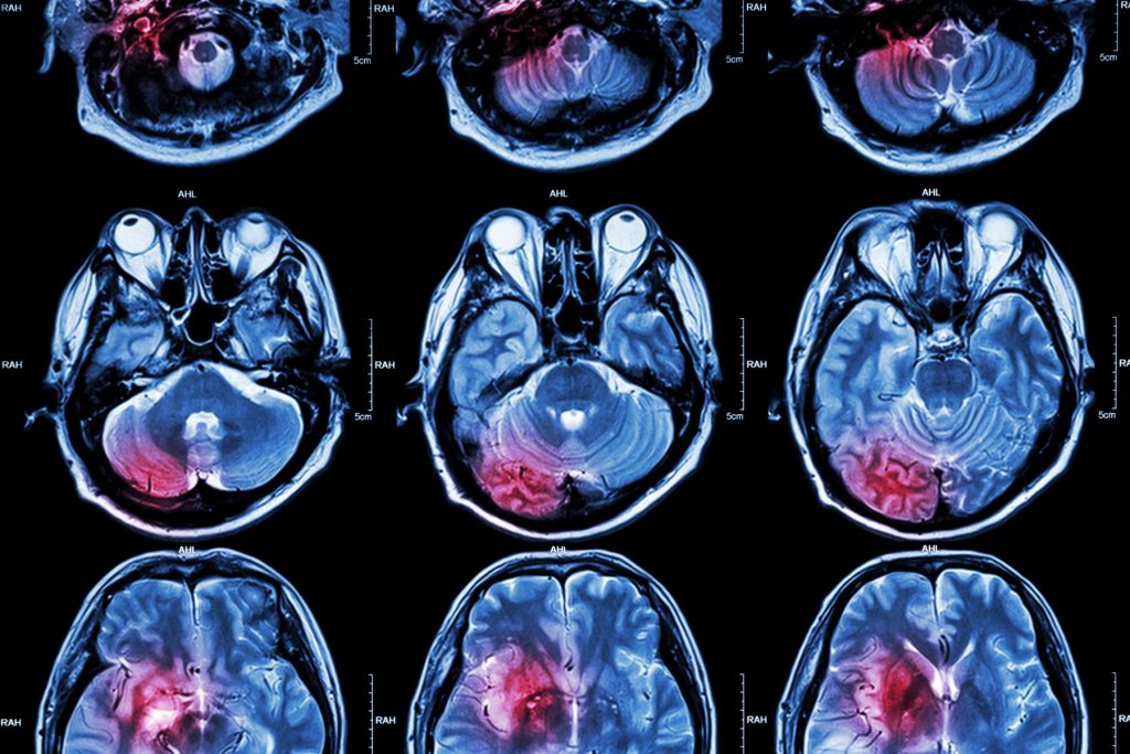 MRI Scan for diagnosis of health care issues and problems