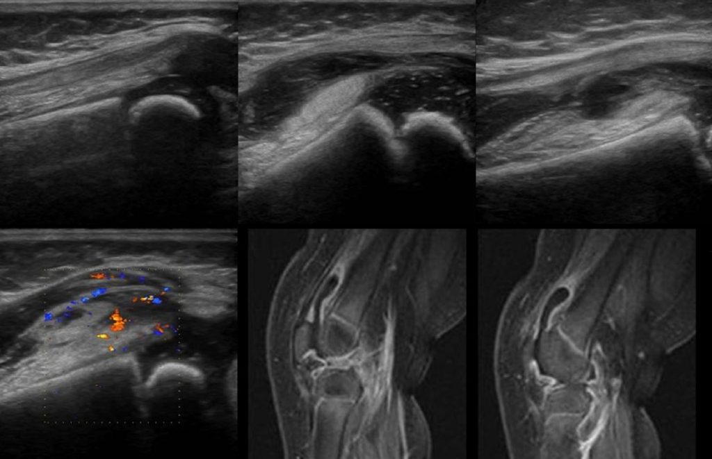 Final Thoughts on Peripheral ultrasound in Dubai