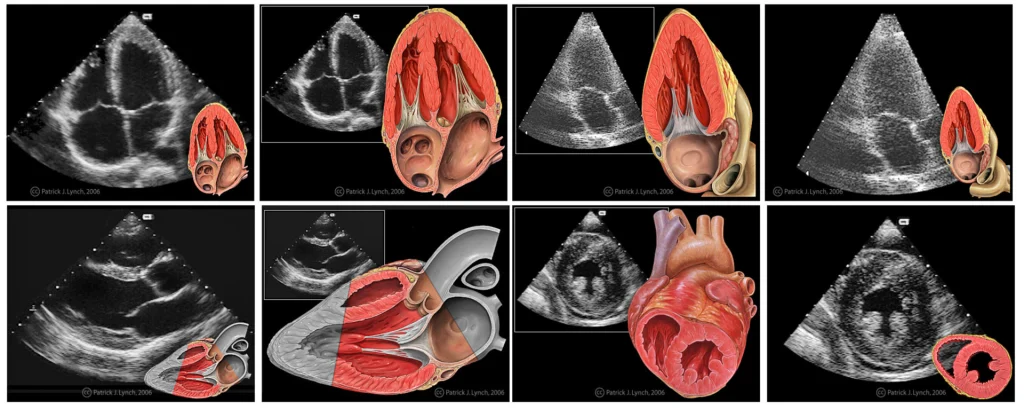 A grid of echocardiogram images paired with anatomical heart illustrations, showcasing heart structure and function.