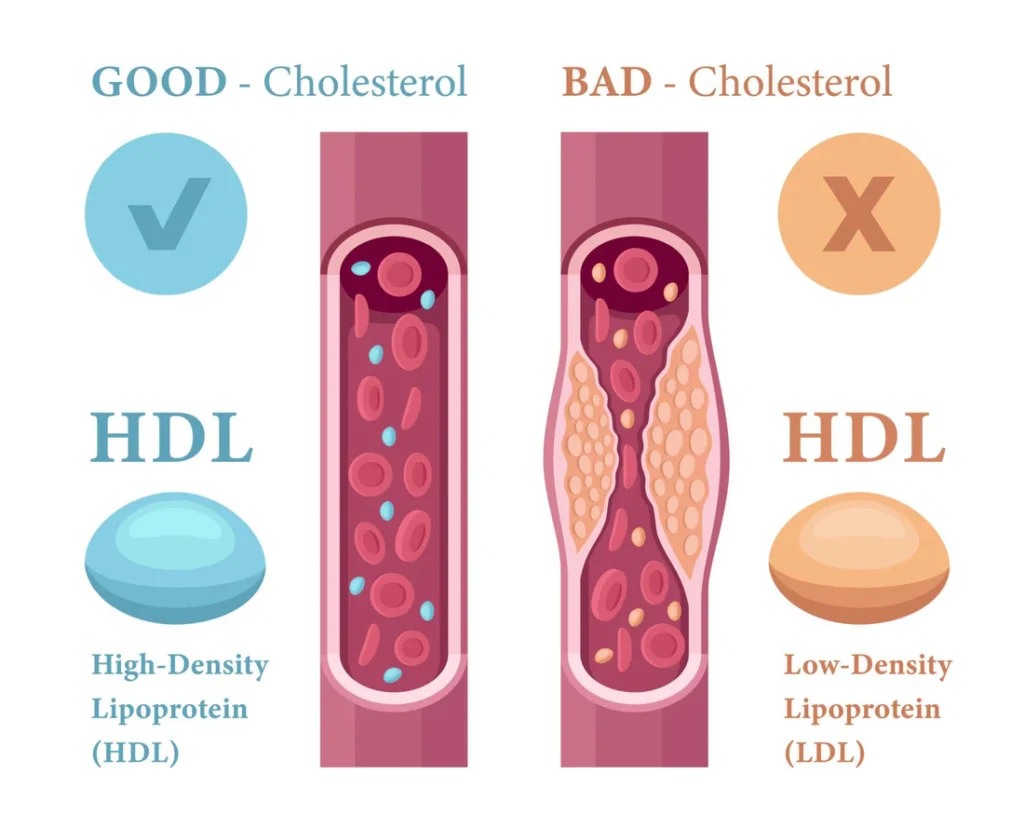 Infographic contrasting good (HDL) and bad (LDL) cholesterol, with visuals of blood vessels and corresponding lipoprotein icons.